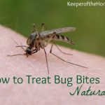 How to Treat Bug Bites Naturally
