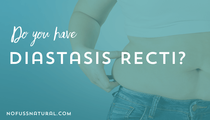 Diastasis Recti Symptoms - How Do I Know I Have Diastasis Recti?