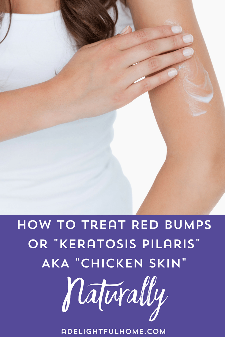 Natural Treatments For Keratosis Pilaris Aka Chicken Skin No Fuss Natural